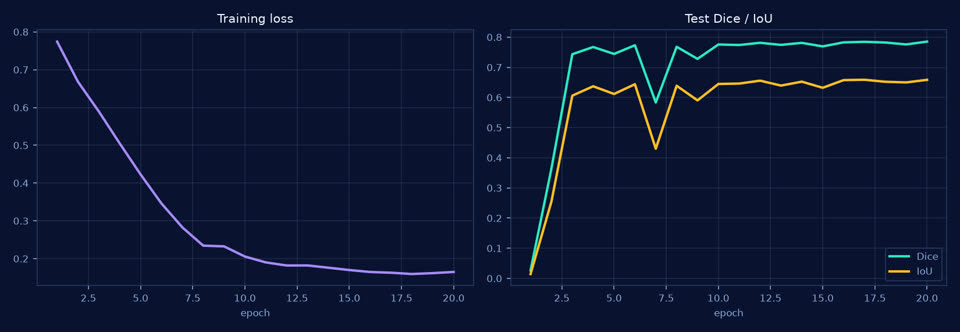 Training loss and test Dice/IoU curves across 20 epochs
